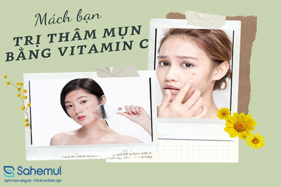 tri-tham-mun-bang-vitamin-c