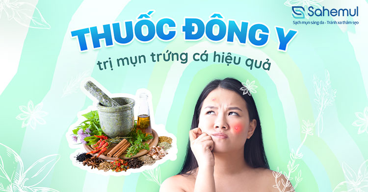 Các bài thuốc Đông y trị mụn trứng cá và lưu ý khi dùng