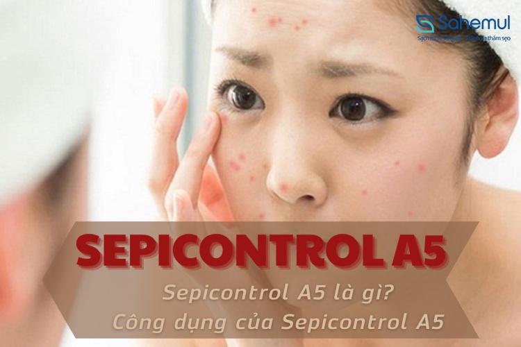 Sepicontrol A5 là gì? Tìm hiểu công dụng của Sepicontrol A5 1