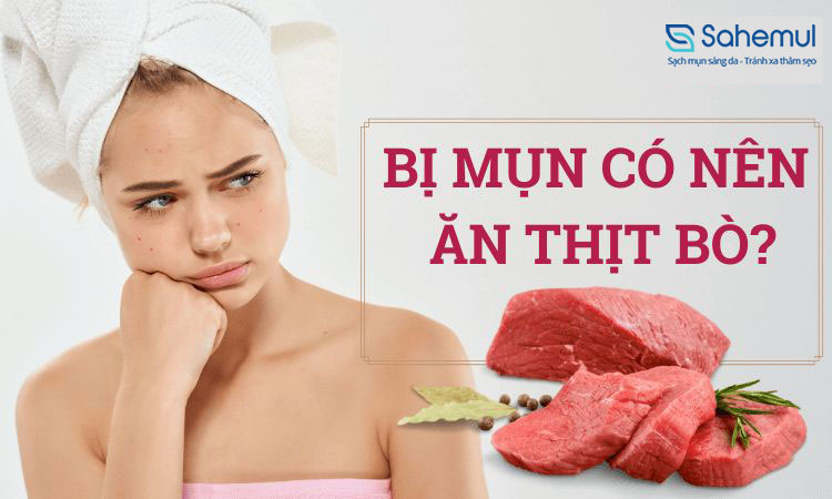 Bị mụn có nên ăn thịt bò không? Nên làm gì khi bị mụn? 1